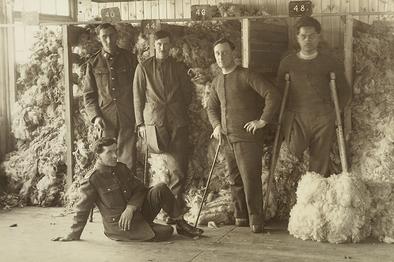 Five men lined up and looking at the camera. Some of them have amputated limbs.